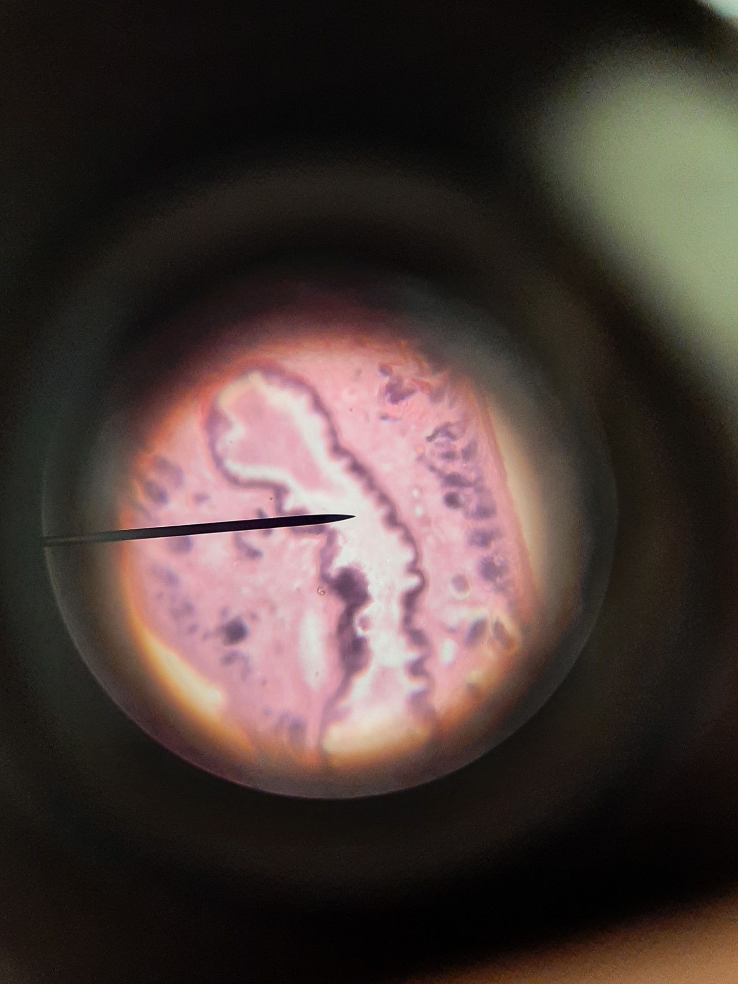 Common Frog Small Intestinal Image 3